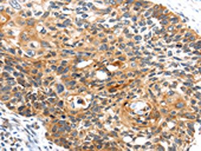 CENPM Antibody