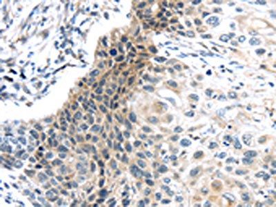 CENPM Antibody