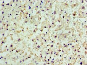 CENPQ Antibody