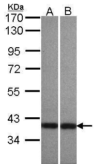 Centaurin alpha 1 antibody