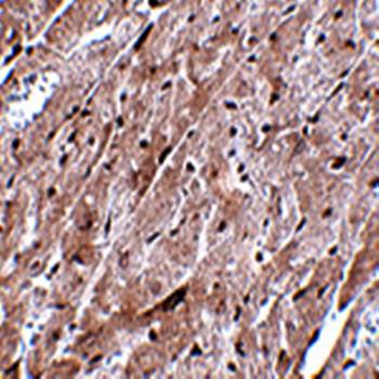 CEP164 Antibody