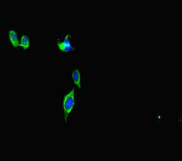 CEP290 antibody