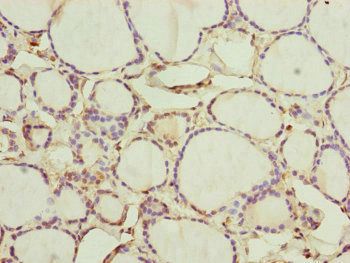 CEP44 Antibody