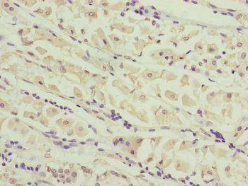CEP44 Antibody