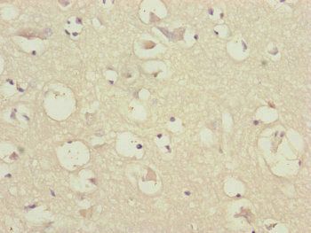 CEP57 antibody