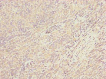CEP57L1 Antibody