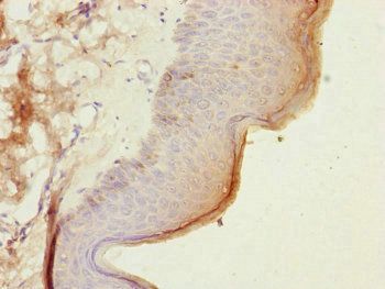 CEP57L1 antibody