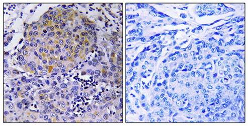 CEP78 Antibody
