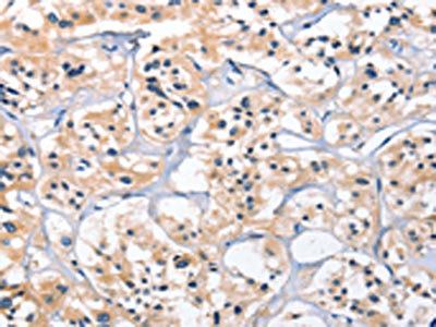 CEP97 antibody