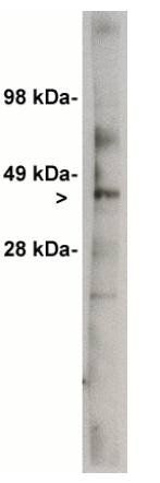 Rabbit Human Ceramide Glycosyltransferase Antibody