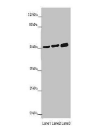 Cerebellar degeneration-related protein 2 antibody