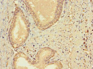 CERKL Antibody
