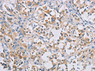 CERKL Antibody