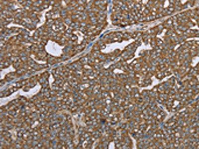 CERS4 Antibody