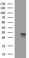 CCT8L2 Antibody