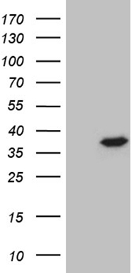 OTUD7B Antibody