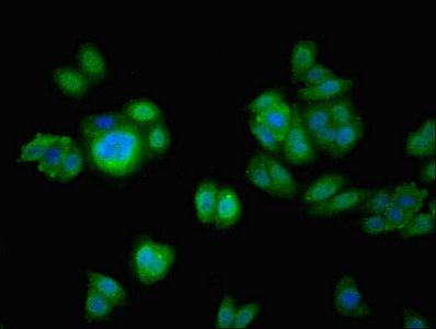 CFAP100 Antibody