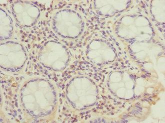 CFAP20 Antibody
