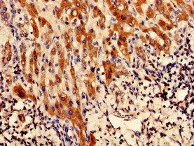 CFAP61 Antibody