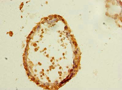 CFAP61 Antibody