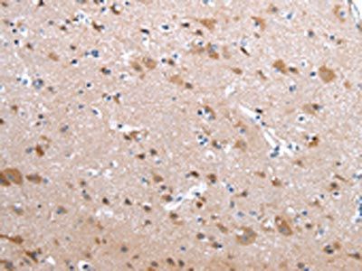 CFC1 Antibody