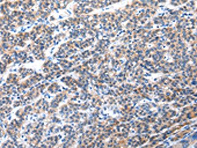CFC1 Antibody