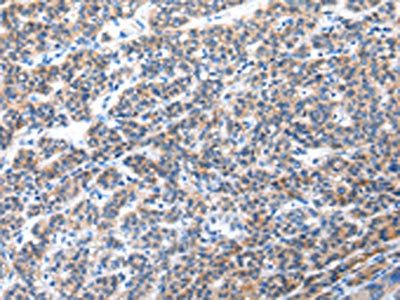 CFC1 antibody