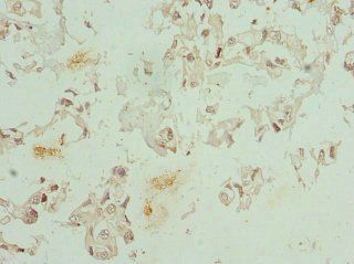 CFDP1 Antibody