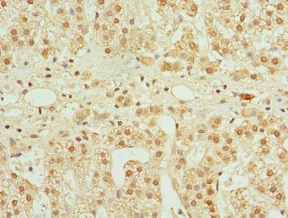 CFDP1 Antibody