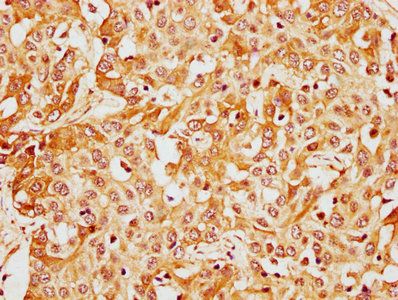 CFHR1 Antibody