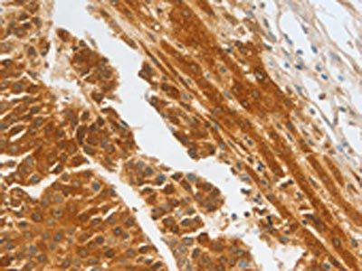 CFHR1 antibody