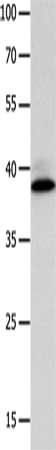 CFHR1 antibody