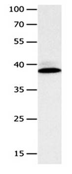 CFHR1 Antibody