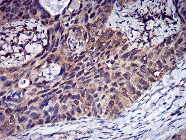 CFHR5 Antibody