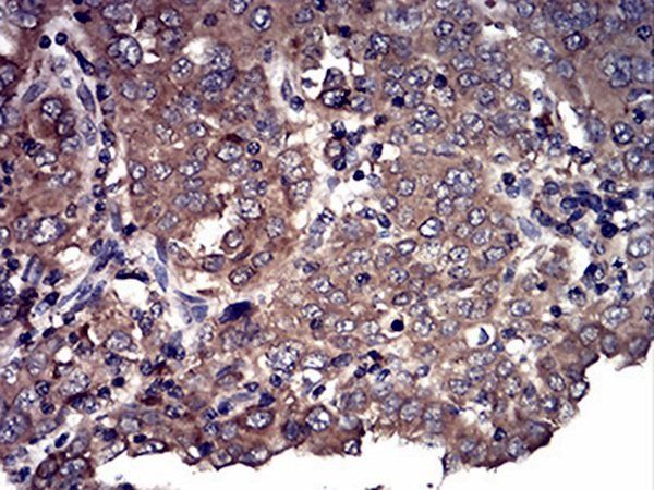 CFHR5 Antibody