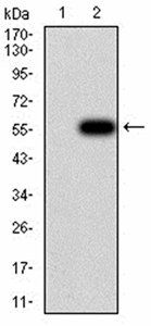 CFHR5 Antibody