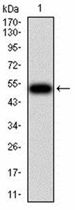 CFHR5 Antibody