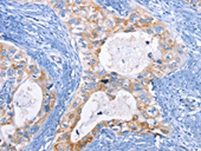 CFLAR Antibody