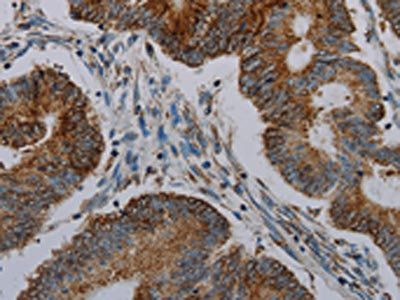 CFLAR Antibody