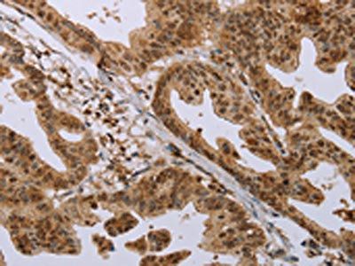 CFLAR Antibody