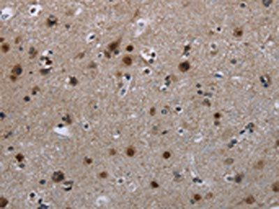 CFLAR Antibody