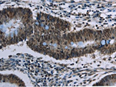 CFLAR Antibody