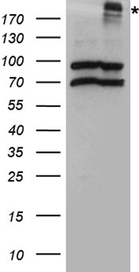 CFTR Antibody