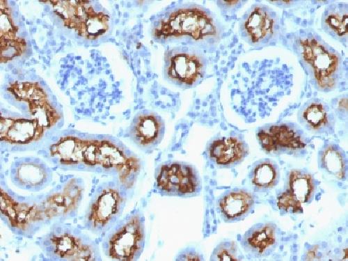 CFTR (Cystic Fibrosis Transmembrane Conductance Regulator) Antibody