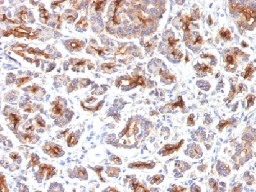 CFTR (Cystic Fibrosis Transmembrane Conductance Regulator) Antibody