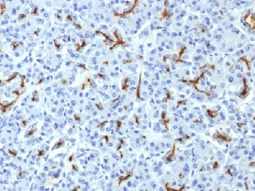 CFTR (Cystic Fibrosis Transmembrane Conductance Regulator) Antibody