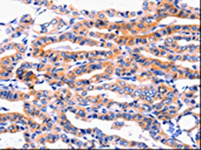 CFTR Antibody
