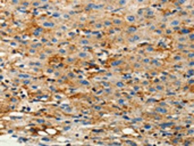 CFTR Antibody