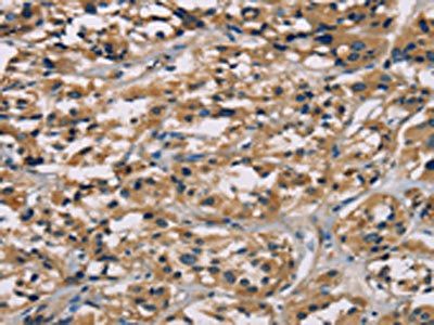 CGA Antibody