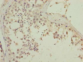 CGGBP1 Antibody